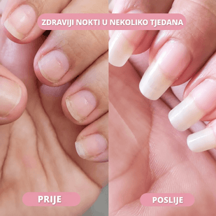 Zaustavlja pucanje i ljuštenje